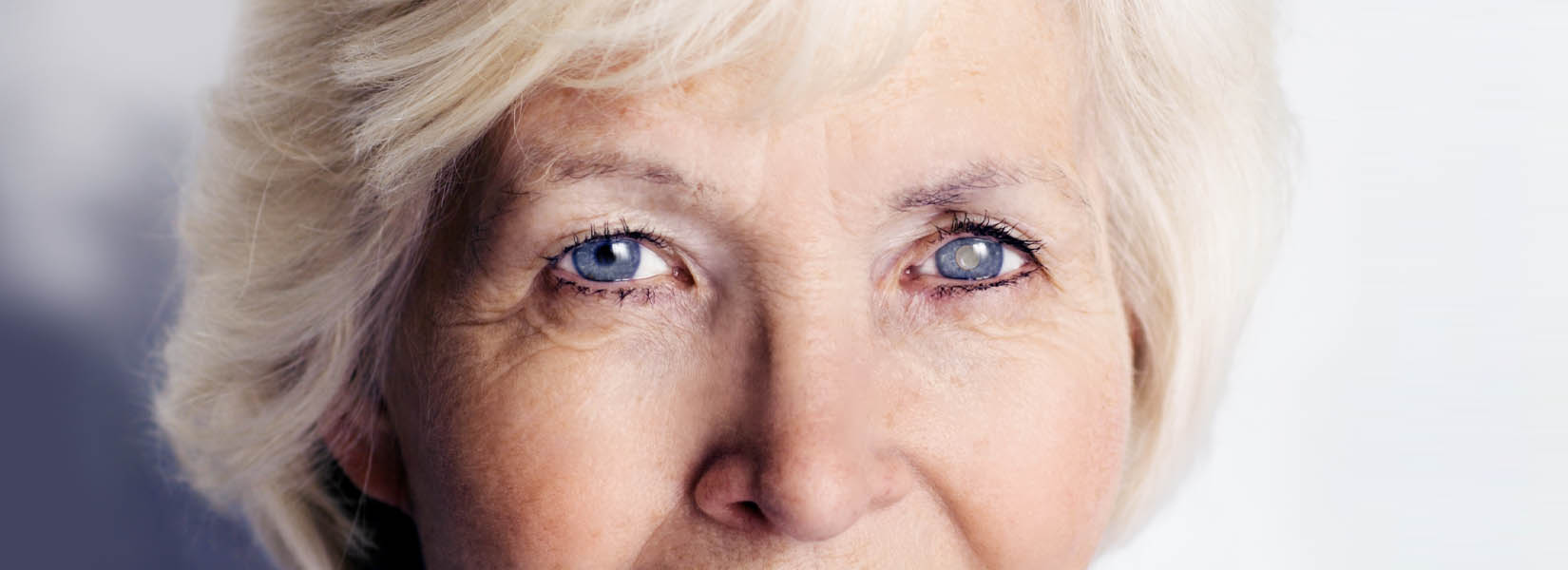 Cataract Surgery in Garland